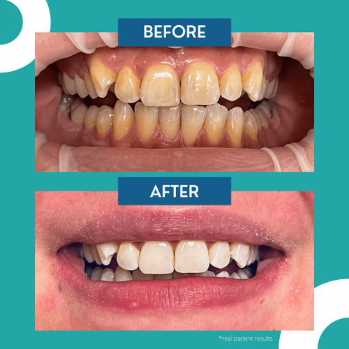 Dentist in Menomonee Falls Riverside Family Dental